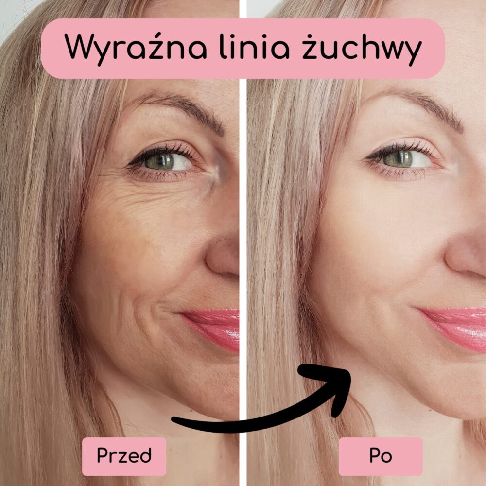 SkinLift Pro (9)_Easy-Resize.com SkinLift Pro (9)_Easy-Resize.com